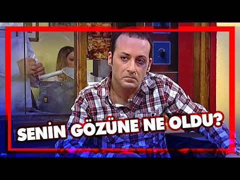 Sacit'in mor gözü merak konusu oluyor - Avrupa Yakası