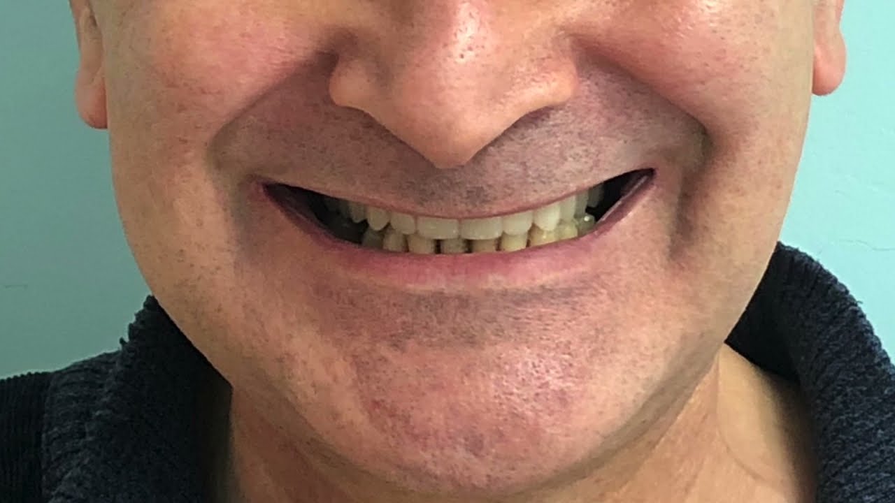 Alessandro Bolzoni-1