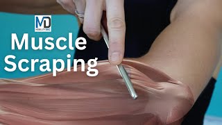 Is Scar Tissue Slowing You Down? Try Muscle Scraping!