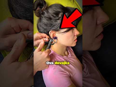 Ova devojka je zamalo izgubila uvo 😱 #shorts #fyp #vidiovo
