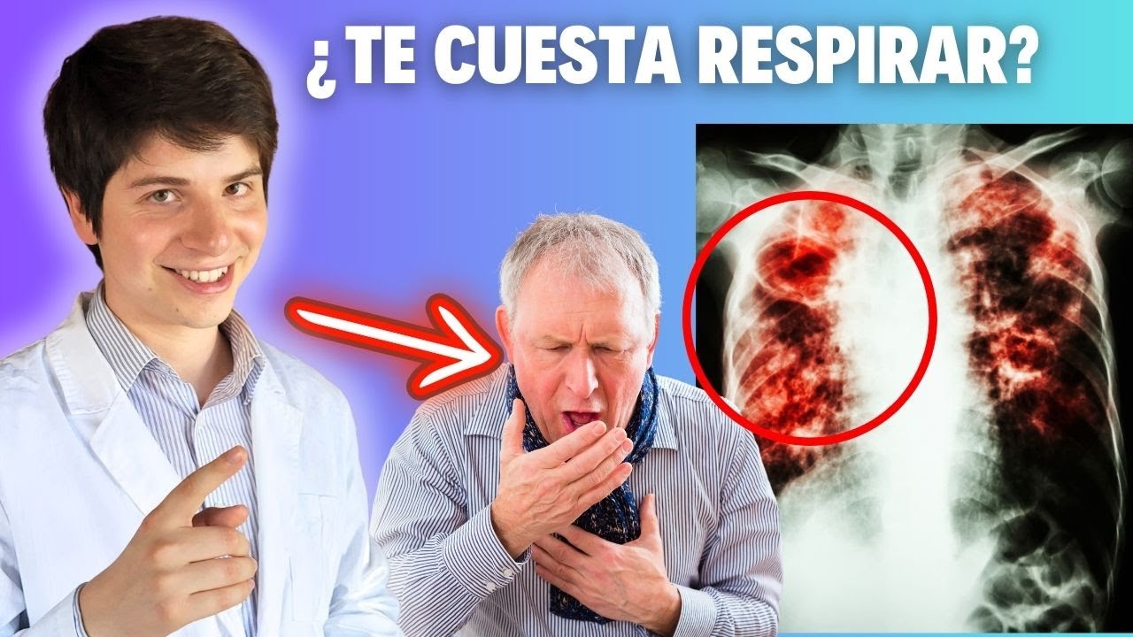FIBROSIS PULMONAR IDIOPÁTICA ► SÍNTOMAS, FISIOPATOLOGÍA, DIAGNÓSTICO y TRATAMIENTO en 11 MINUTOS 😉