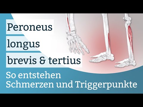 Peroneus longus, brevis & tertius pain, trigger points and their activation