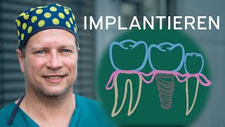 Erklärvideo klassisches Implantat in Berlin