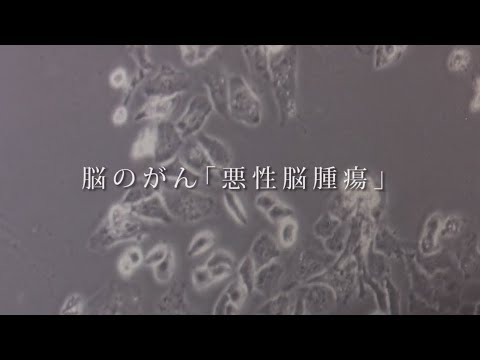 【ココカラ】Research51「悪性脳腫瘍に挑む！血液バイオマーカー」/医薬保健研究域医学系 中田光俊教授/金沢大学研究紹介動画
