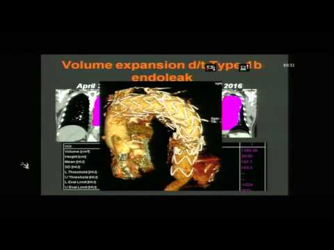 CARDIO RADIOLOGY CME PART 4