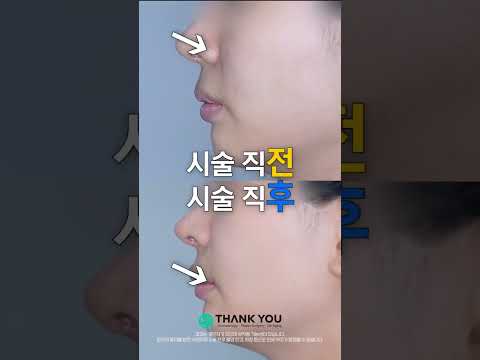 땡큐성형외과 Clips