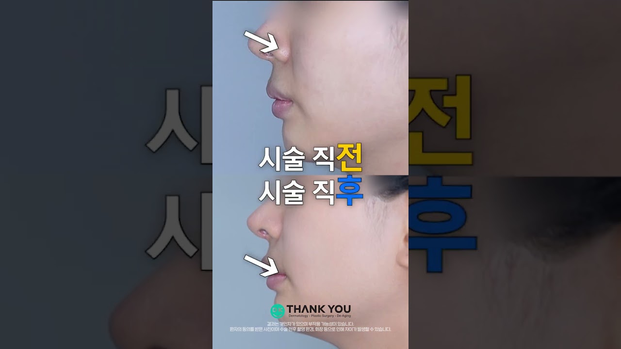 땡큐성형외과 Clips