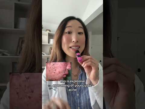 #accutane causes 4-6 weeks of #acne purging, but if you experience explosive cystic acne...