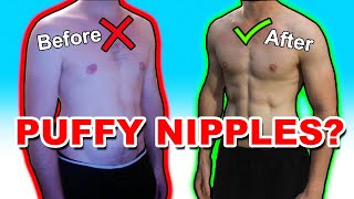 HOW I GOT RID OF MY PUFFY NIPPLES WITHOUT SURGERY!