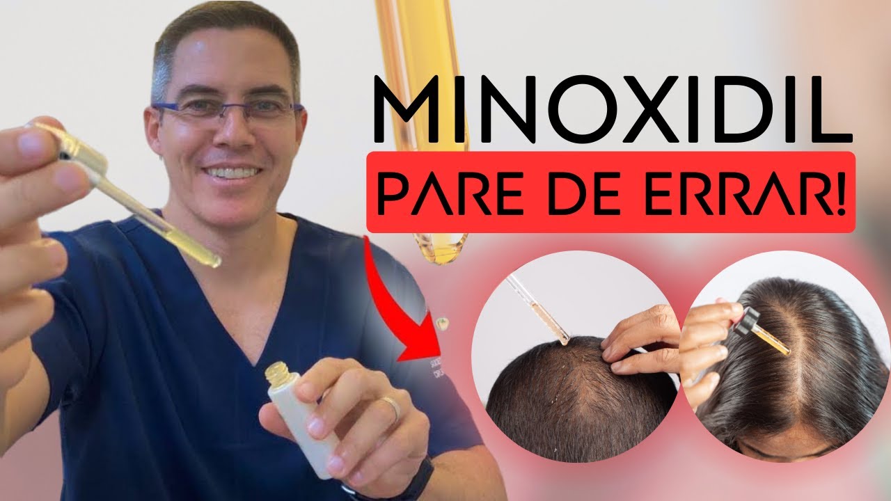 O jeito certo de aplicar Minoxidil.