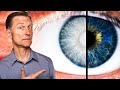 This Vitamin Reverses GLAUCOMA