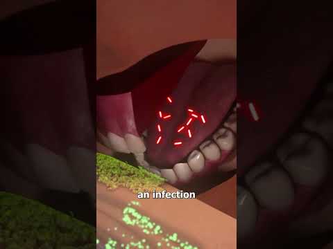 Sucking Out Snake Venom 😮