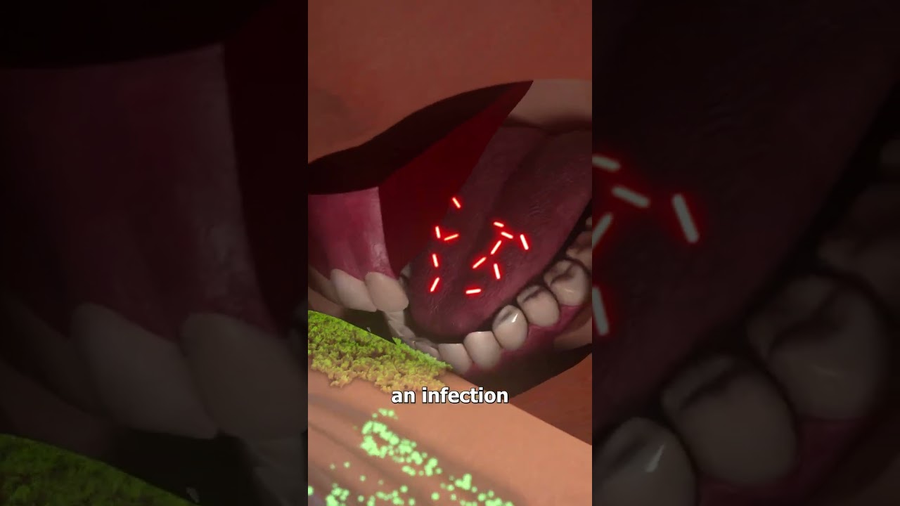 Sucking Out Snake Venom 😮