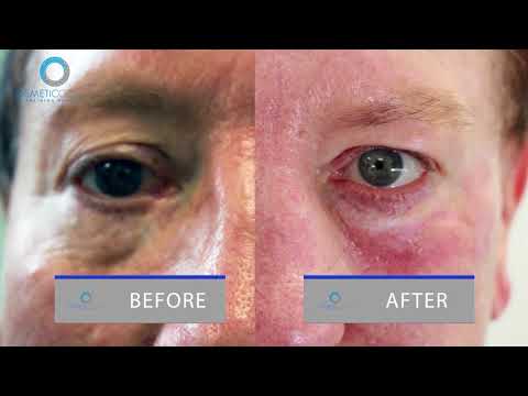 download lagu mp3 mp4 Plasma Blast, download lagu Plasma Blast gratis, unduh video klip Plasma Blast