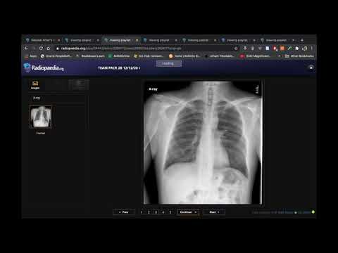 TEAM FRCR 2B Viva Practice Session (MSK, GU & Breast Modules Revision). 12th December, 2020.