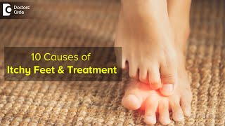 10 CAUSES OF ITCHY FEET: How to get relief ? Right Treatment - Dr. Urmila Nischal |Doctors