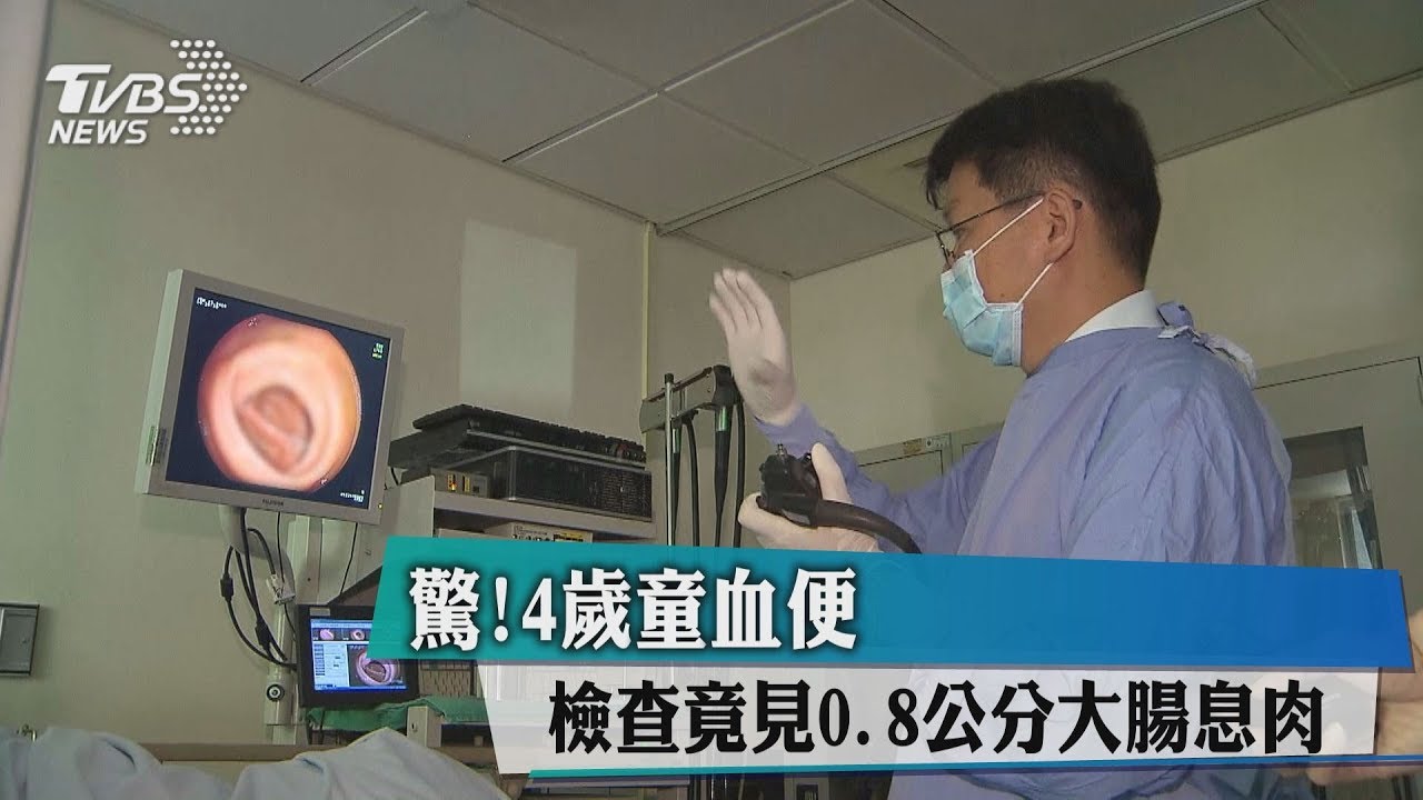 驚!4歲童血便 檢查竟見0.8公分大腸瘜肉