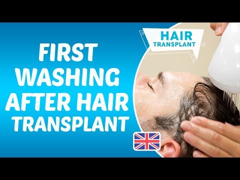 First washing after hair transplantation Dr  Hamid Aydin