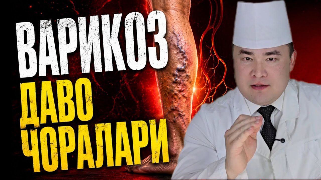 ОЁҚДА ВАРИКОЗ ҲАҚИДА ВА ДАВО ЧОРАЛАРИ 