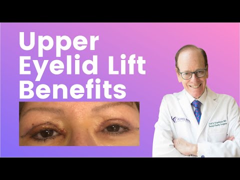 Eyelid Lift Explained | Benefits of a Blepharoplasty