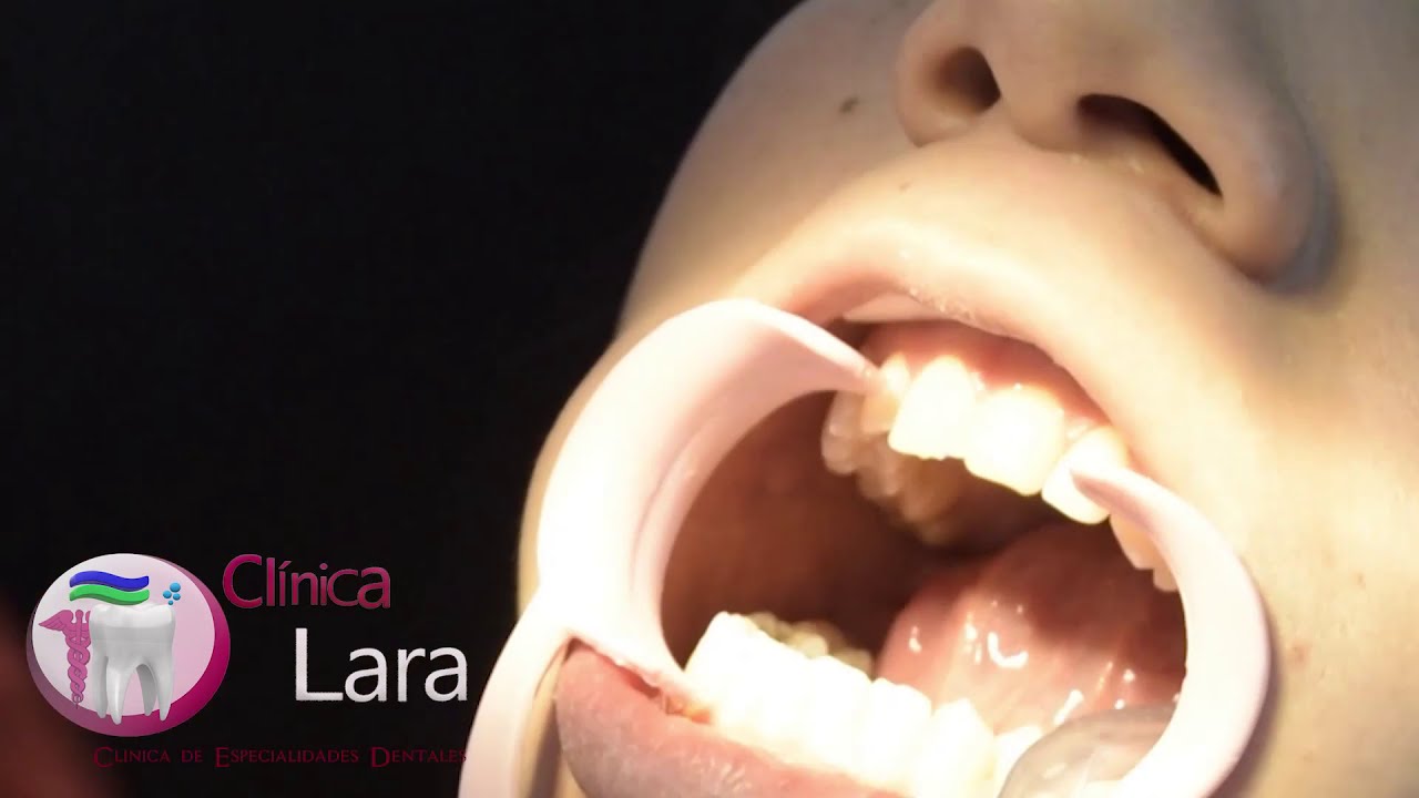 Yovana Lara Ramírez-76