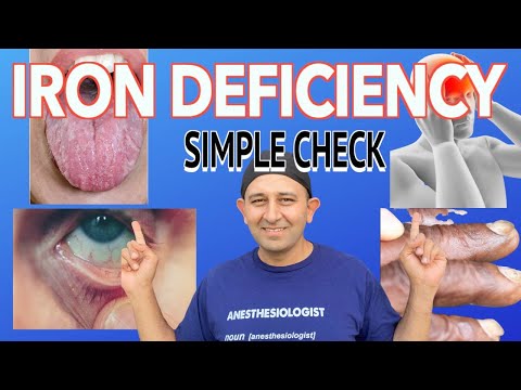 6 Warning Signs You Have Iron Deficiency Anemia