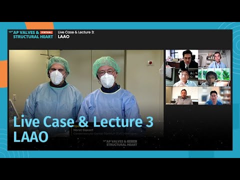 [AP VALVES & SH 2021] Live Case & Lecture 3: LAAO
