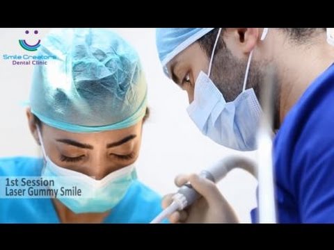 HOLLYWOOD SMILE - Laser Gummy Smile + Veneers - Dr Elie GEMAA - Smile Creators