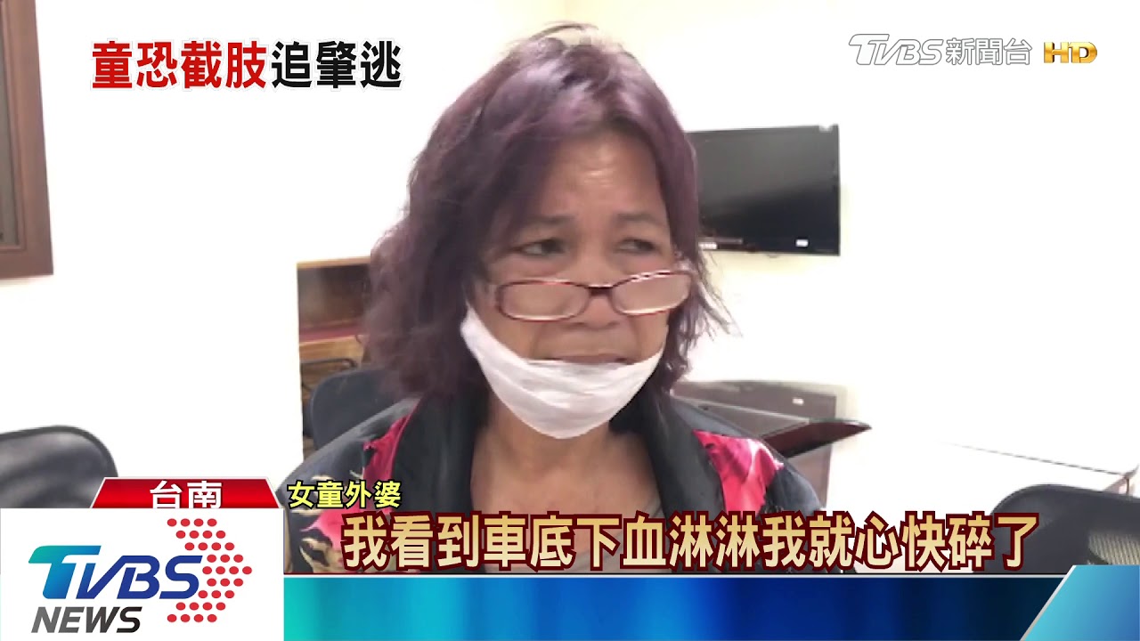 國道兩度被撞甩車底　7歲女童命危恐截肢
