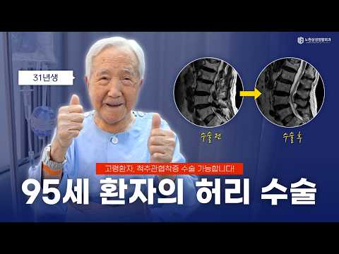 95세 환자의 양방향척추내시경 결과는?｜고령 환자의 수술 후기