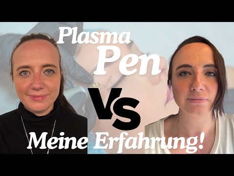 Schlupflider straffen ohne OP – Mein ehrlicher Plasma Pen Erfahrungsbericht mit Heilungsverlauf