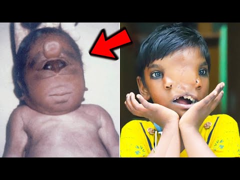 10 Most Unusual And Rare Humans That Are One in a Million
