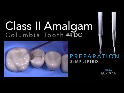 Amalgam Simplified Preparation - Columbia #4 DO | Two Burs Only