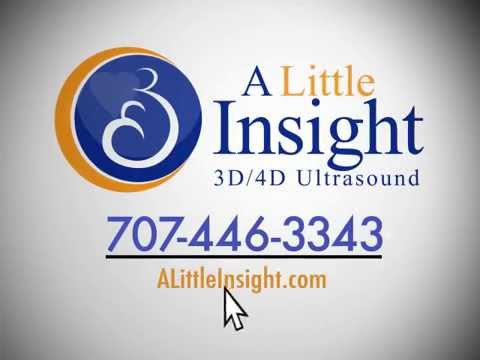 image-How much does a 3D ultrasound cost?