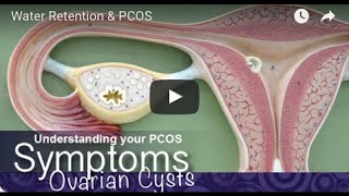 Water Retention and PCOS