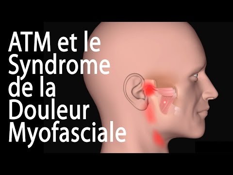 TMJ and Myofascial Pain Syndrome, Animation.