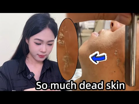 💈ASMR | Remove fuzz and dead skin from a man's face.