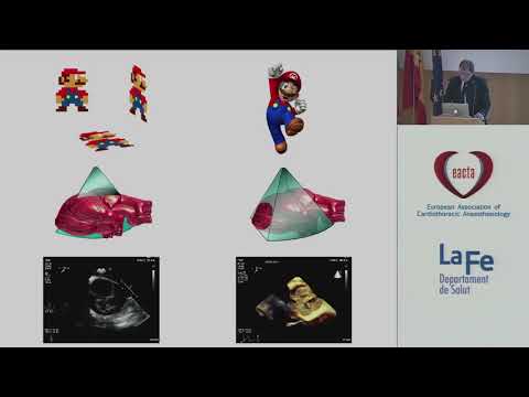 3D TEE: Basic principles. Acquisition and interpretation