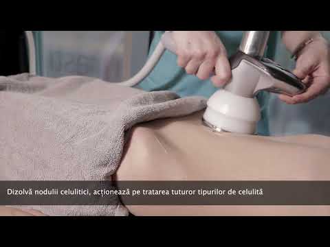 pierde grăsime armpit în 2 săptămâni pierdere ideală în greutate sequim