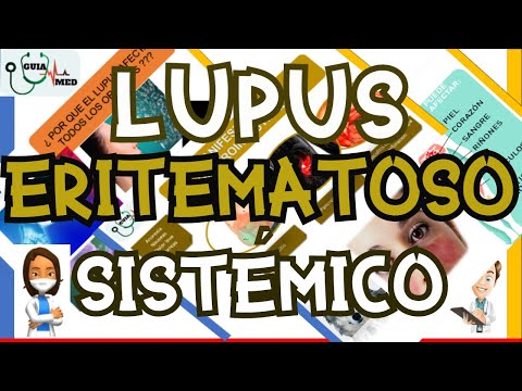 LUPUS ERITEMATOSO SISTÉMICO SINTOMAS | GuiaMed