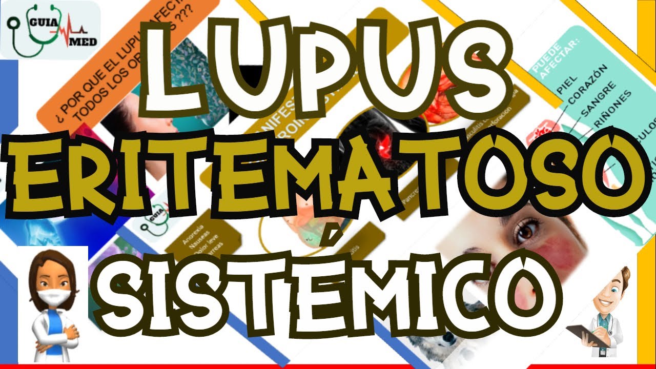 LUPUS ERITEMATOSO SISTÉMICO SINTOMAS | GuiaMed