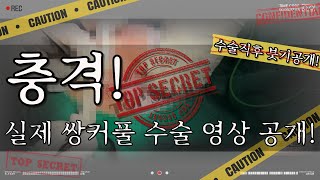 병원에서 쌍커풀 수술하는 과정 대공개 (feat, 커스텀성형외과)