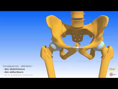 comment soigner adducteurs