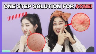 [BnA l Acne Care] How to Get Rid of Acne! ☝️One Step Solution for Acne #EP9