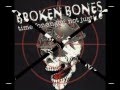 Broken Bones- Advertisements From Hell