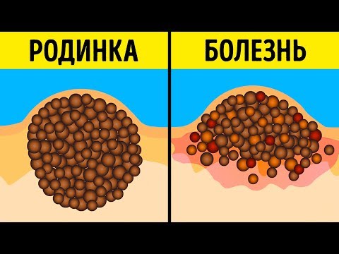 Маска от пигментных пятен мери кей отзывы Хрен от веснушек