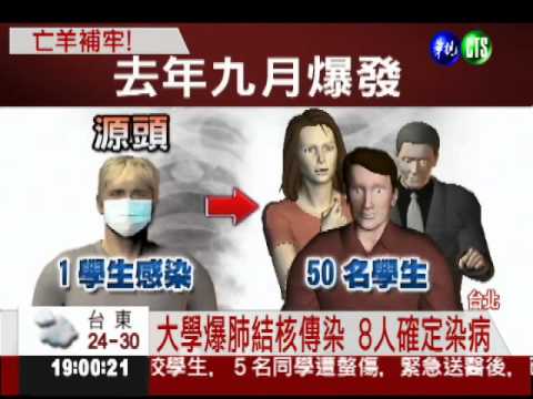 大學爆肺結核傳染 8人確定染病