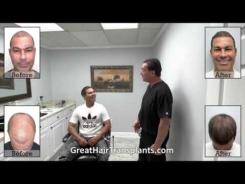 Dr  Brett Bolton does unbelievable work for a patient who was completely bald

