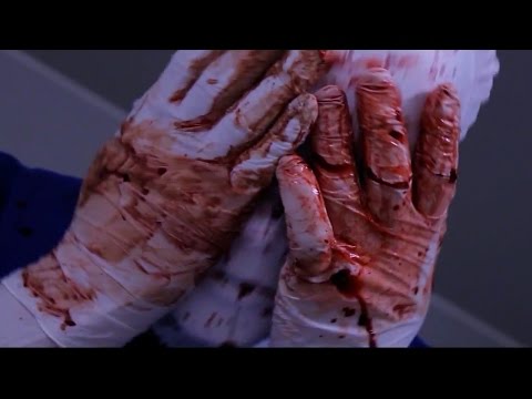 BBK 2015 - Finale (RR): IDOL vs Chris Dolmeth (FEAT. NOW)