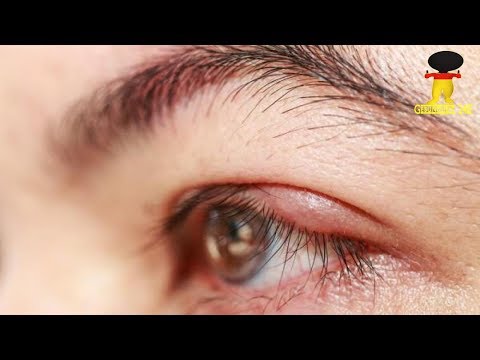Übung für Patienten mit Hypertonie für die Gewichtsabnahme Blutdruck 90-69